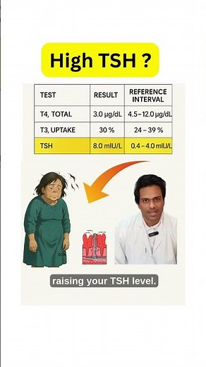 High TSH Meaning - how does someone with High TSH Look? | Thyroid symptoms , causes