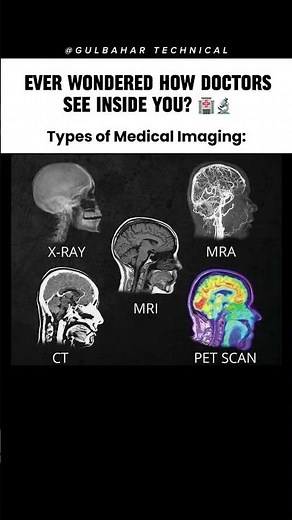 Ever Wondered How Doctors See Inside You? 🏥🔬 | Types of Medical Imaging