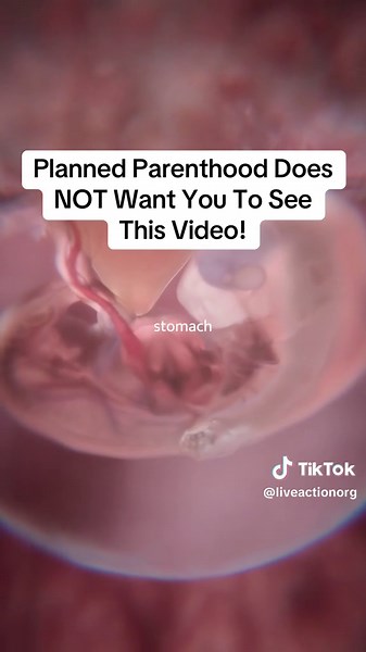 The first weeks of pregnancy show what actually happens from the moment of conception: unique DNA is formed, cells divide, organs begin to develop, and a new human life starts its earliest stages of growth. These facts are rarely shown by the abortion industry, even though they’re basic human biology. This video of Baby Oliver breaks down what occurs in the womb week by week so people can see the reality of early prenatal development for themselves. #prolife #BabyOliver #PlannedParenthood #Relat