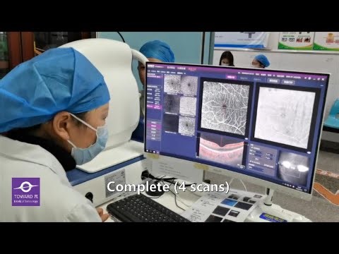 Work flow of TowardPi SS-OCT in daily practice, Model: Yalkaid (100KHz), 4 scans in 2 minutes, Uncut
