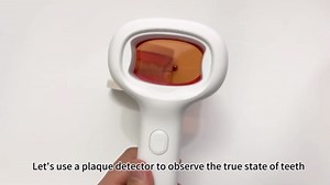 Plaque Disclosing Tablets Alternatives Rechargable Dental Plaque Detector Light Shows Plaque Lamp Instant Display Tooth Calculus Discloser for Kids or Adults Correcting Brushing Habits