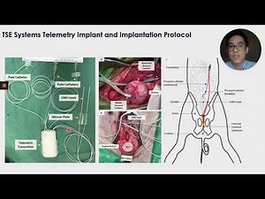 #116 Urodynamic Studies and Telemetric Monitoring of Bladder Function After Traumatic Thoracic S...