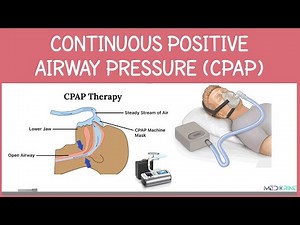 Continous Positive Airway Pressure (CPAP): Indications, Physiology, Settings and Contraindications