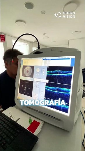 Tomografía de coherencia óptica OCT
