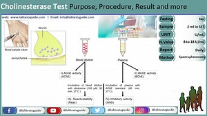 Cholinesterase | Lab Tests Guide