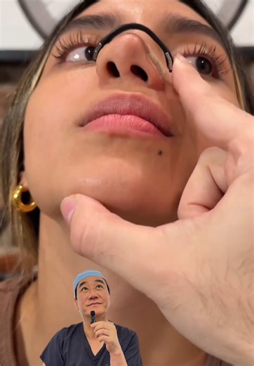 If you can never breathe through one side of your nose, wake up congested, or always feel “blocked,” you might have a deviated septum. Rhinoplasty can fix the structure, open your airway, and finally help you breathe clearly again. VC: @Bella