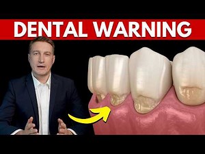 What Happens If You Ignore Notches in Your Teeth – Dr. Lowe On Dental Abfraction
