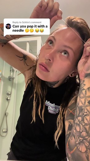 How to Properly Drain a Pimple and Cyst at Home