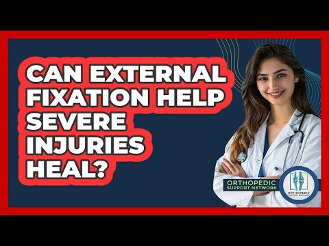 Can External Fixation Help Severe Injuries Heal? - Orthopedic Support Network