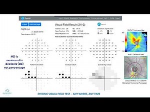 How to interpret the results of an Eyeonic Online Visual Field Test | Visual Field Test 101