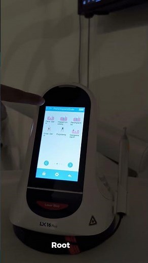 Revolutionizing Dentistry with Diode Laser Technology | Pain-Free & Precision Dental Care