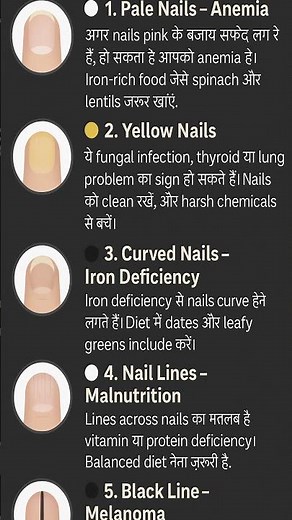 Nail Disease Warning Signs You Should Never Ignore | Nail Health Symptom Explained #shorts