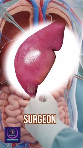 Liver Resection Surgery: How the Liver Heals and Regrows After Cancer Removal