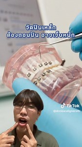 79K views · 7.8K reactions | อยากจัดฟันใสต้องเลือก Dr Clear Aligners...