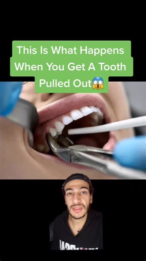 Tooth Extraction: Pulling Out Teeth Process Explained