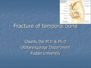 Fracture of temporal bone - SlideServe