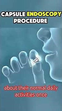 Capsule Endoscopy Procedure | 3D Animation with English Voice | How It Works Step by Step