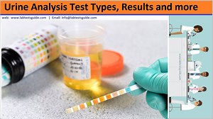 Urine Analysis: Purpose, Types, Preparation, Procedure, and Interpretation of Results
