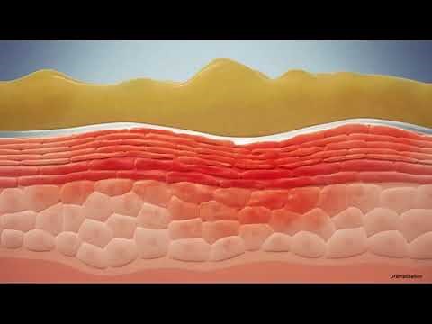 3M™ Cavilon™ Advanced Skin Protectant