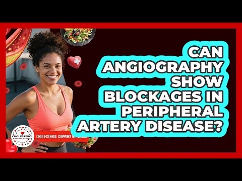 Can Angiography Show Blockages In Peripheral Artery Disease? - Cholesterol Support Network