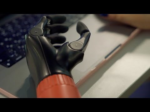 CYBI Hand - Body-Powered Prosthetic Hand