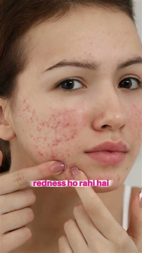 Color Corrector Makeup Guide: How to use Orange, Green & Purple!