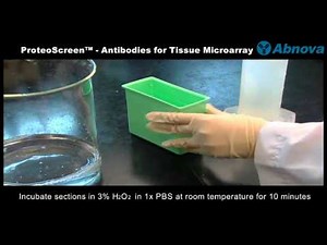 Tissue Microarray
