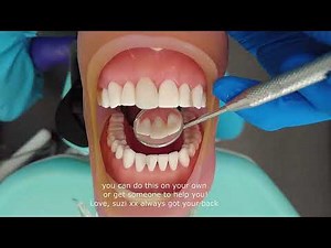 How to fix your chipped tooth at home beautifully