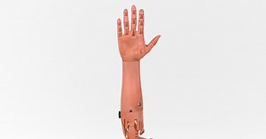 The 3D-printed bionic arm that is disrupting the prosthetics industry