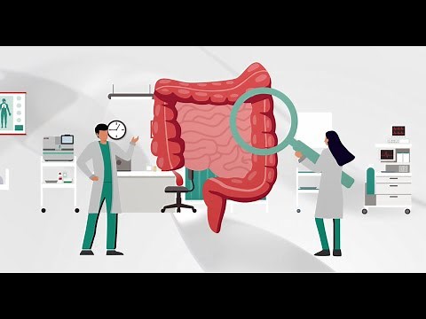 Colorectal Cancer Screening: Fecal Immunochemical Test (FIT) | OC-SENSOR