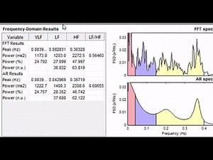 Heart Rate Variability Analysis Using Kubios Software and Excel Template