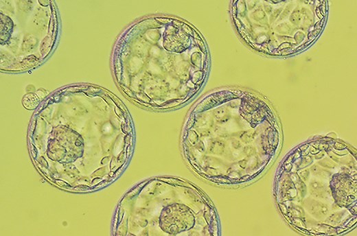 Frequently Asked Questions about Frozen Embryo Transfers