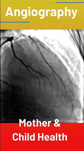 Coronary Angiography