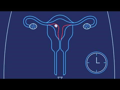 How Does Pregnancy Happen? | Pregnancy Symptoms & Signs