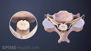 What Spinal Cord and Nerve Compression Feels Like