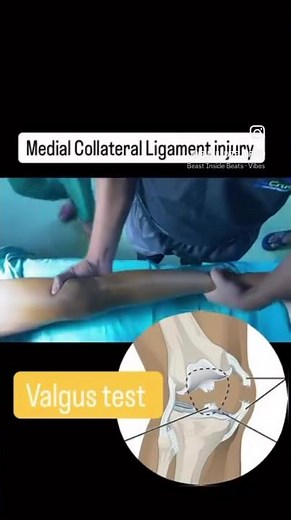 MCL Injury Test | Valgus Stress Explained #kneepain #ligamentinjury #sportsinjury