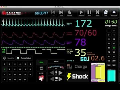 EKG Simulator - ECG Simulator