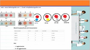 Blood Group Test Procedure | Lab Tests Guide