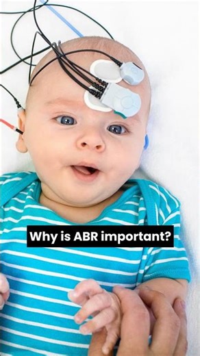 ABR Testing: Your Hearing's Silent Guardian