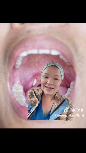 #stitch with @Ashley how to never get another tonsil stone: 1. Have great home care, oil pull, brush, floss and tongue scrape 2. Check for vitamin deficiencies, tonsil stones and tarter build up are signs the body is not absorbing calcium #tonsilstones #gurunanda #gurunandaproducts