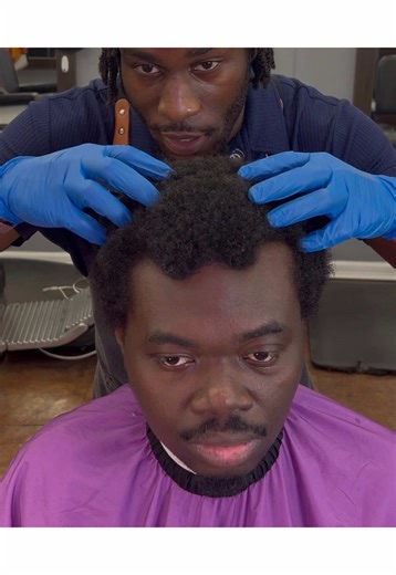 Natural Skin Fade Transformation for Receding Hairlines