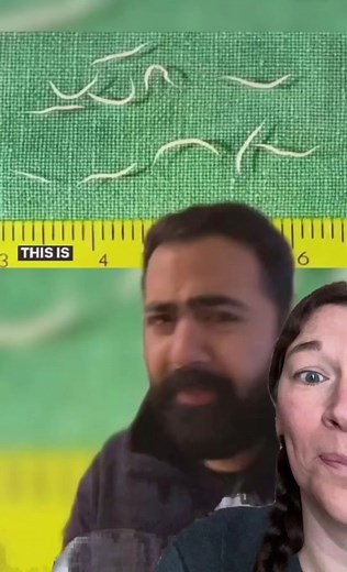 Understanding Pinworms: Causes and How to Treat Them