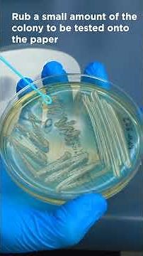 How to Do an Oxidase Test to Identify Gram-Negative Bacteria #microbiology #hospital #gonorrhea
