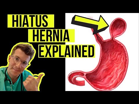 Everything you need to know about a HIATUS HERNIA | Causes, symptoms, diagnosis & treatment