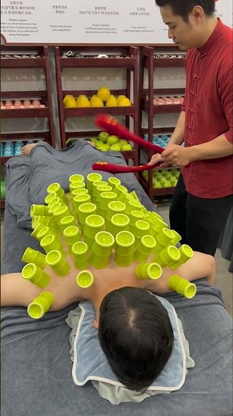 [ASMR] So Relax with Cupping Therapy #cuppingtherapy #cupping #relax #asmr #massage