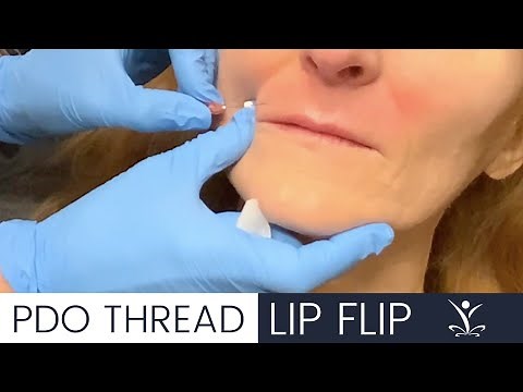 Get a Lip Flip with PDO Threads