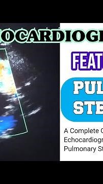 Echocardiographic Assessment Of Pulmonic Stenosis