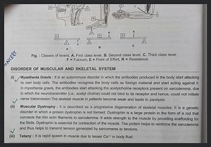 Fig. : Classes of levers. A. First class lever, B. Second class... | Filo