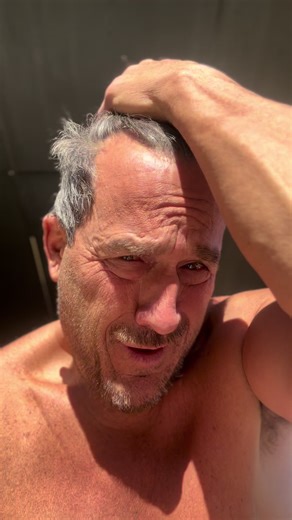 ‼️You to contact your doctor immediately and go get your blood work either today on Saturday or on Monday. Don’t wait 💀 I’m worried you may bl**d to death internally from swollen veins in your esophagus that you don’t know about yet all due to heavy drinking.. this is why your heartburn may be so bad right now Many anxiety symptoms, mimic alcohol cirrhosis symptoms and I just wanted to jump on her and tell you that your mom has entered the Lane of cirrhosis so her symptoms she’s having now is n