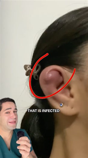 Why you should NEVER get this type of piercing